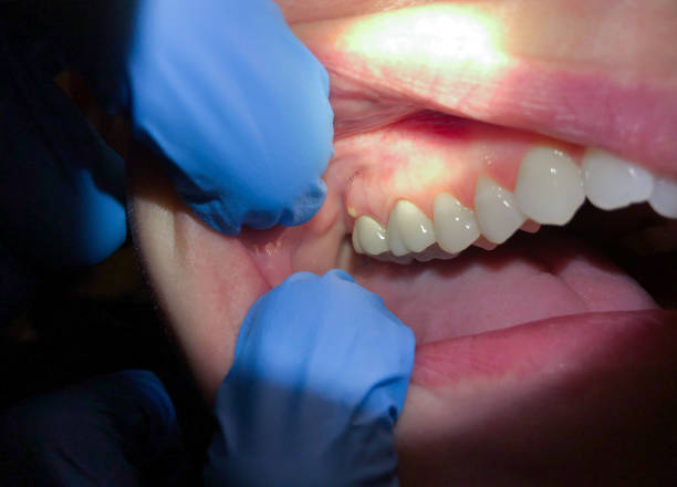 Best Pediatric Emergency Dentist in Berlin, OH