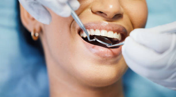 Best Emergency Dental Care for Broken or Chipped Teeth in Berlin, OH