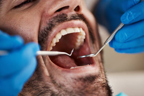 Best Emergency Treatment for Dental Infections or Abscesses in Berlin, OH