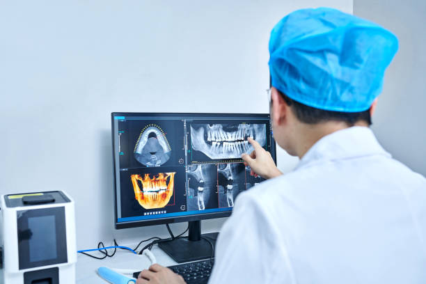Best Emergency Wisdom Teeth Removal in Berlin, OH